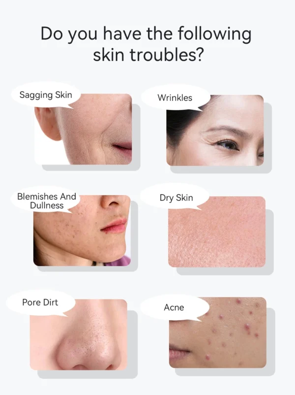 Pro Face Lifting Massage Skin Rejuvenation - Image 11