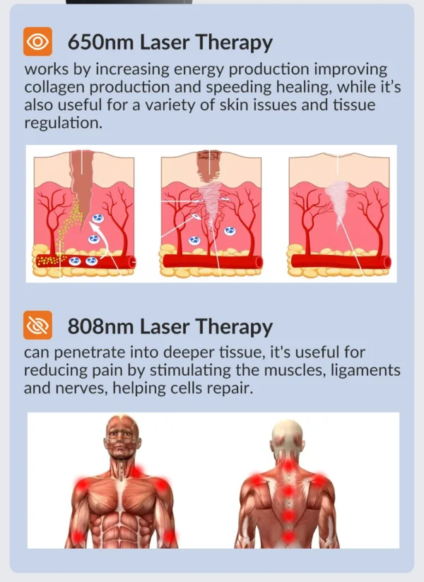 Laser Pain Relief Therapy Physiotherapy - Image 12