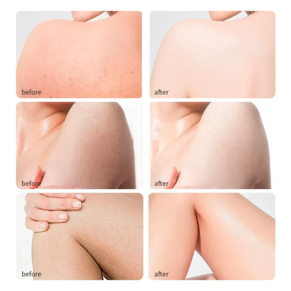 100% Pure Castor Oil Promotes Healthy Skin and Hair Thickens - Image 4