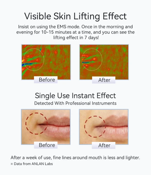 Pro Face Lifting Massage Skin Rejuvenation - Image 18