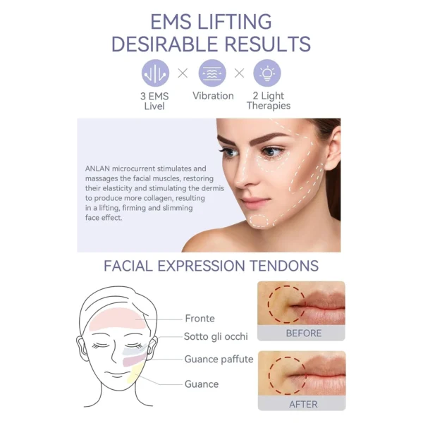 ANLAN EMS Facial Massager - Image 4