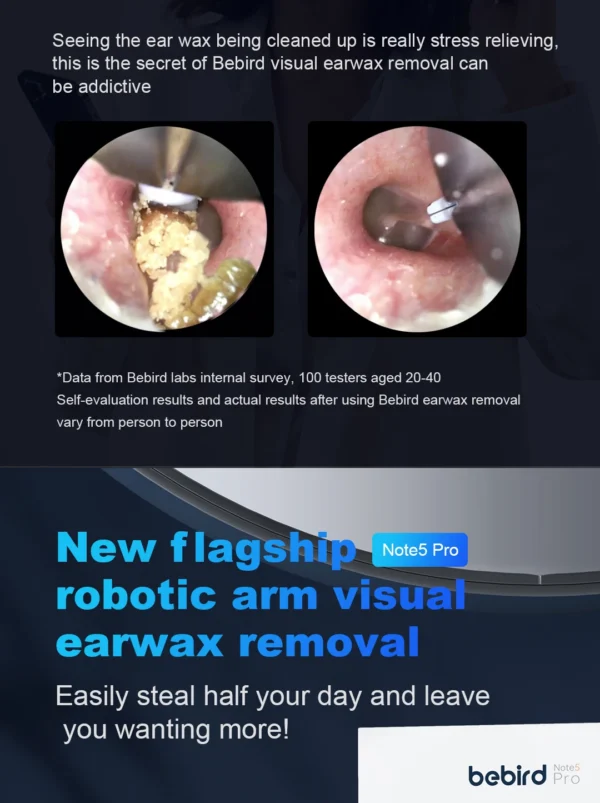 Ear Cleaner Smart Visual Ear - Image 14