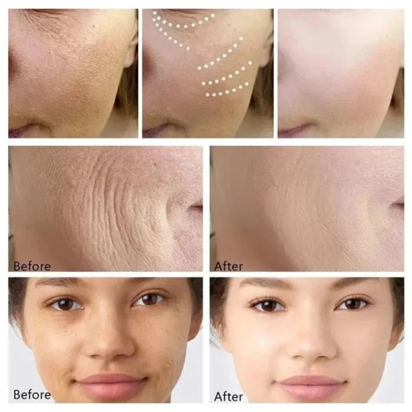 Bio Collagen Face Mask - Image 14